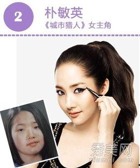 整容后的明星网红,揭秘整容后的明星网红新形象