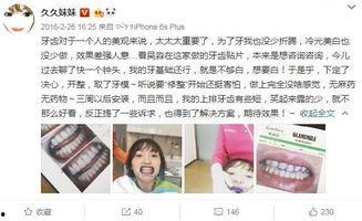 明星网红为什么贴面,网红明星贴面热潮背后的社交密码解析