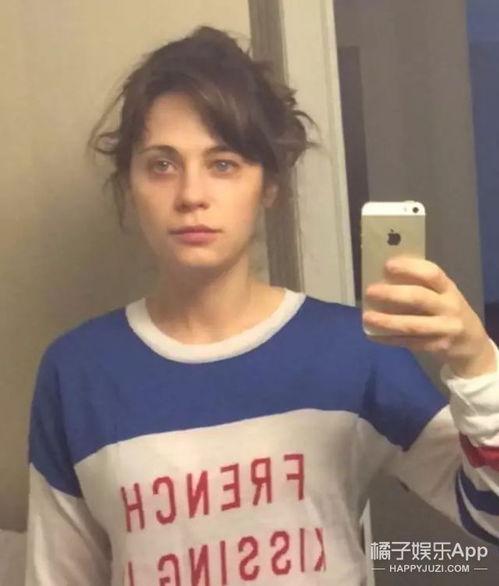 有斑的明星网红,揭秘有斑明星网红的独特魅力”